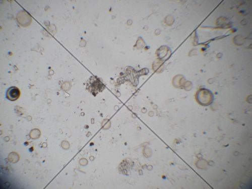 Lake El'gygytgyn algae diatoms microorganisms